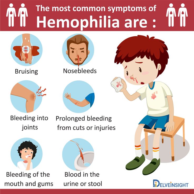 Hemophilia: Understanding the Genetic Disorder and Its Management