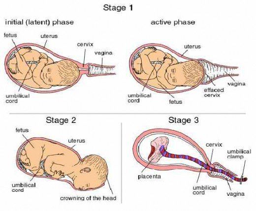 Stages of Labor: A Detailed Guide