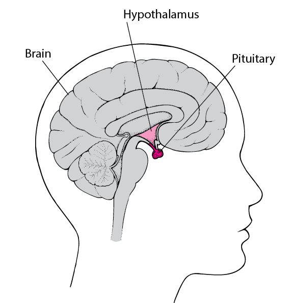 Pituitary Disorders – Causes and Management