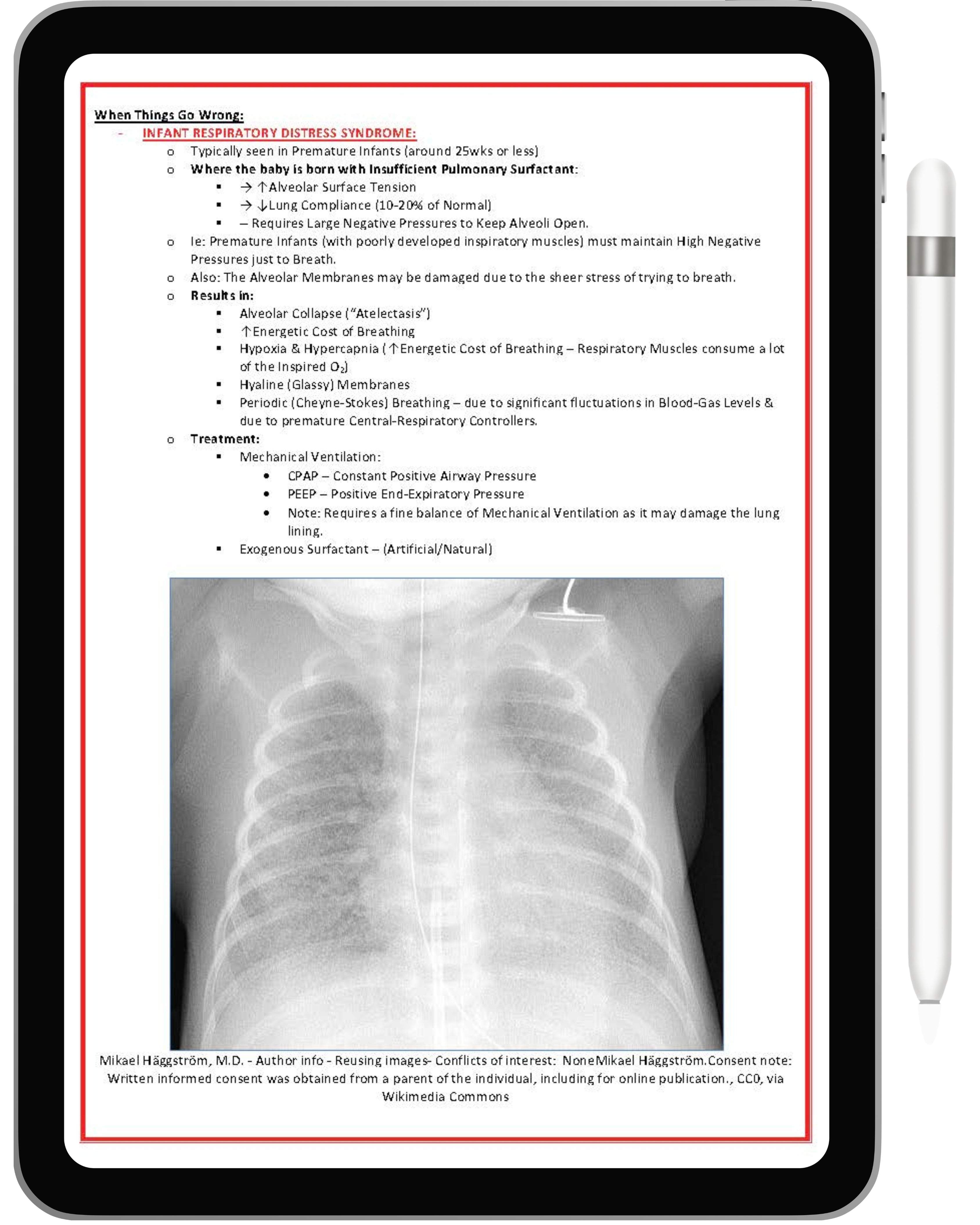 Respiratory System